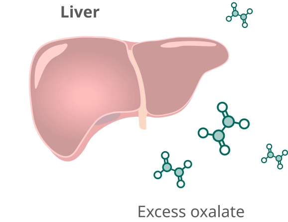 Liver surrounded by excess oxalate illustration